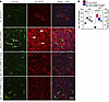 AAV-mediated delivery of the SLC2A1-DT lncRNA reduces neuroinflammation in