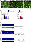 AAV-mediated delivery of the SLC2A1-DT lncRNA stimulates brain capillary fo