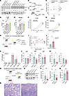 Genetic deletion of Fbxo11 expands MDS progenitors in vitro and worsens mur