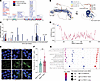 Identification of FBXO11 mutations in myeloid malignancies reveals a functi