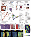 The spatial and single-cell landscape of GBC with direct liver invasion.