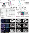 The combination of CXCL9 and LGALS4 in liver invasion tissue predicted prog