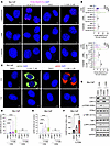 STING activation induced by CDK12/13 inactivation is TRC dependent.
