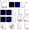 Tumor emboli in human VETC HCCs retain an immunosuppressive niche similar t