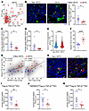 High TGF-β1 expression in TECs is associated with enhanced Treg enrichment