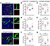 Restoration of VETC formation by recombinant Angpt2 supplementation reestab