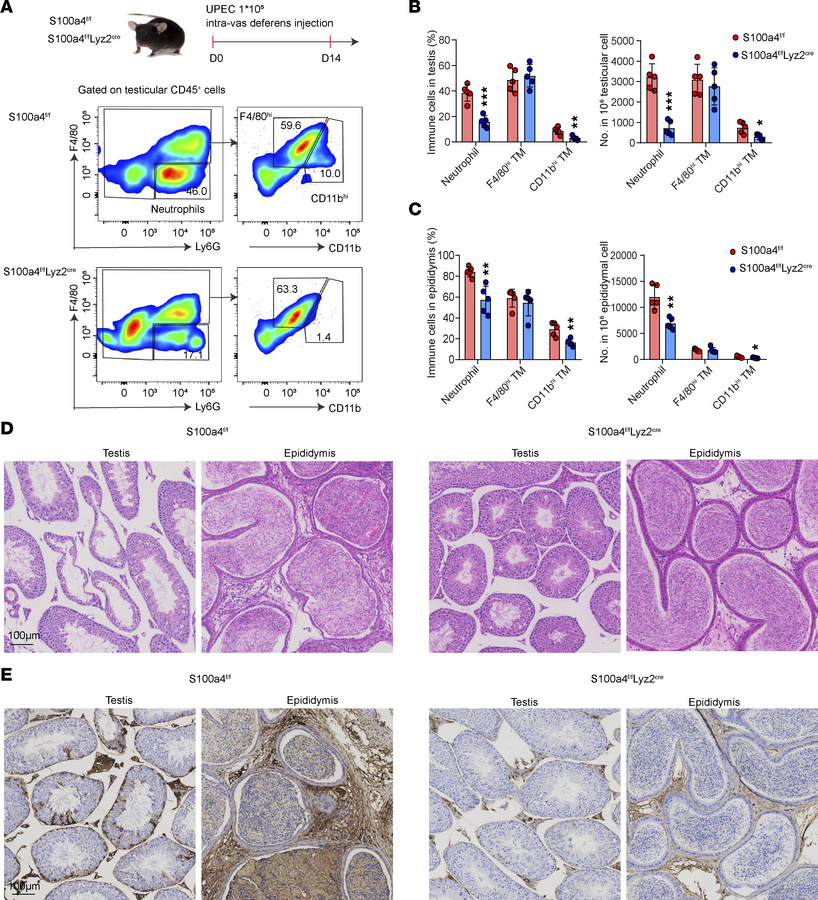 Macrophage S100a4 deletion inhibits fibrosis in epididymis/testis after ...