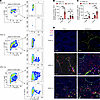 UPEC infection promotes accumulation of S100a4+ TMs in the testes and epidi