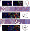 UPEC infection-induced accumulation of S100a4+ cells and collagen I in the