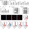 S100a4 activates the p-STAT3 signaling pathway in macrophages.