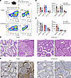 Macrophage S100a4 deletion inhibits fibrosis in epididymis/testis after UPE