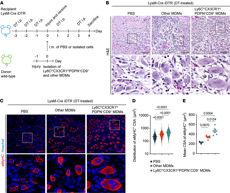 Transfer of Ly6ChiCX3CR1loPDPN+CD9+ MDMs (Mrep) improves impaired muscle...