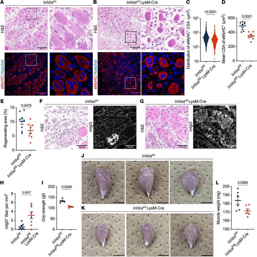Mrep-derived activin A is essential for proper muscle regeneration.
(A a...