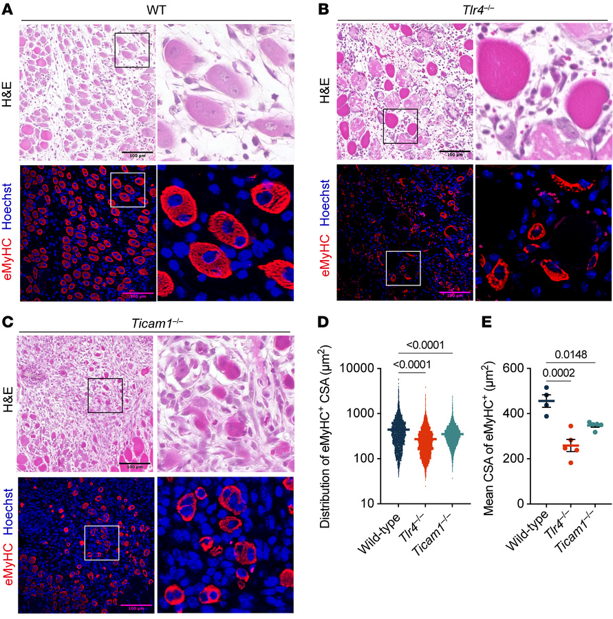 TLR4/TRIF-mediated signaling is required for proper muscle regeneration....