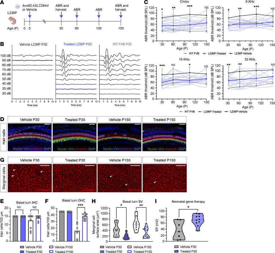 Neonatal delivery of Anc80.hSLC26A4 improves hearing improvement and pre...