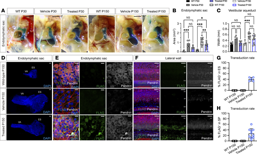 Neonatal delivery of Anc80.hSLC26A4 reduces the enlarged endolymphatic s...
