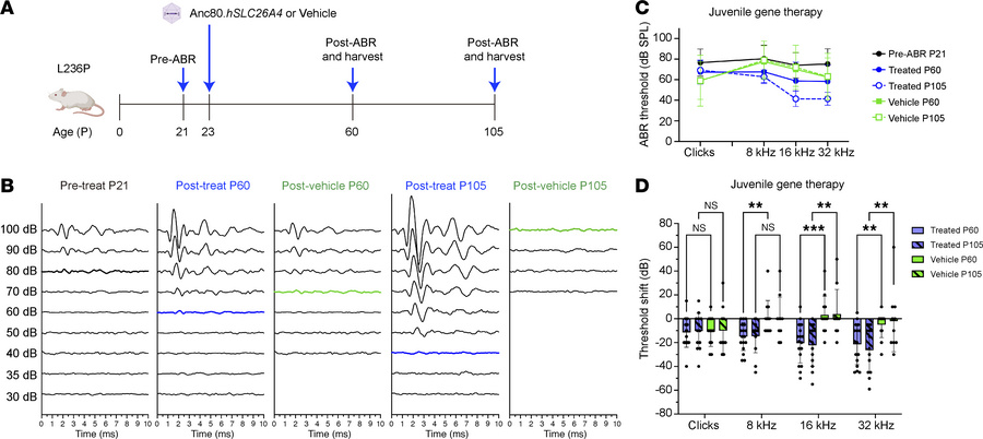 Delivery of Anc80.hSLC26A4 improves hearing in L236P-mutant juvenile mic...