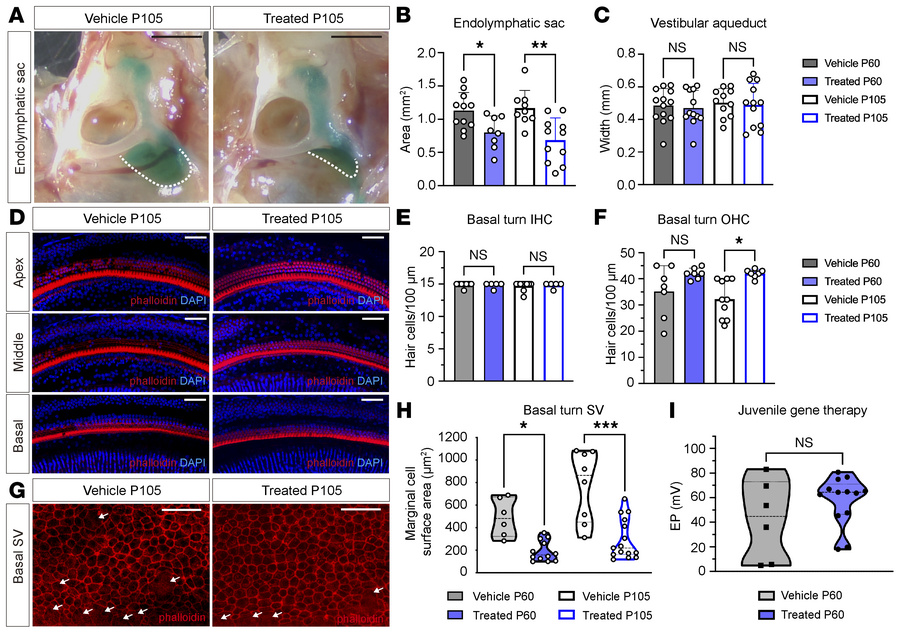 Juvenile delivery of Anc80.hSLC26A4 reduces the size of the enlarged end...