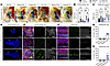 Neonatal delivery of Anc80.hSLC26A4 reduces the enlarged endolymphatic sac