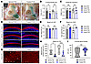 Juvenile delivery of Anc80.hSLC26A4 reduces the size of the enlarged endoly