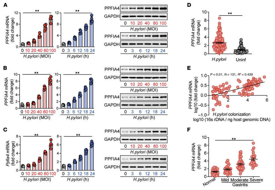 PPFIA4 is increased in GECs from gastric mucosa of H. pylori–infected pa...