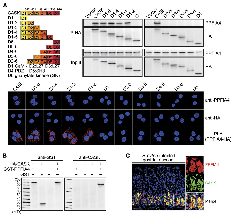 PPFIA4 binds to domains of CaMK to the first L27 of CASK during H. pylor...