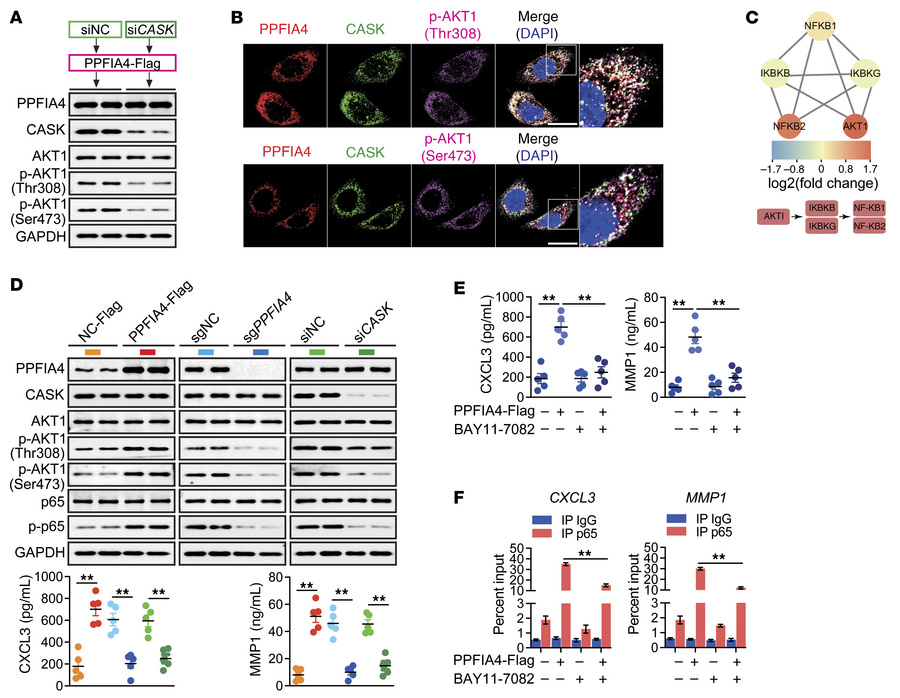 PPFIA4/CASK promotes NF-κB phosphorylation via interaction with and acti...