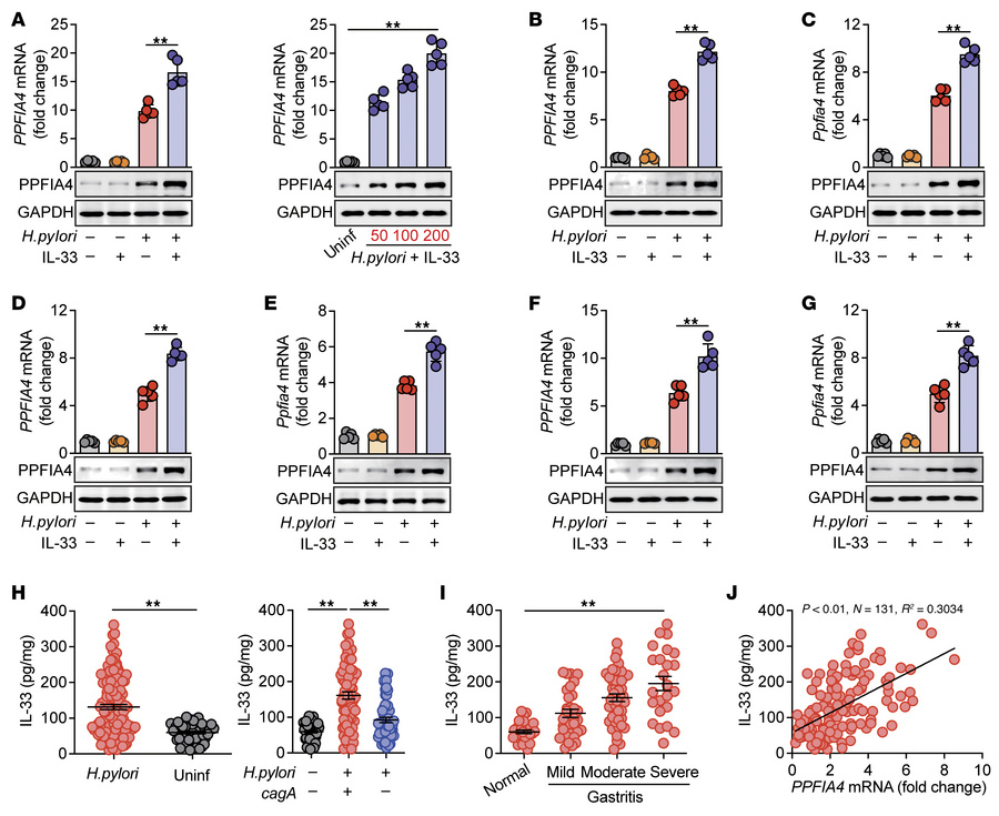 
H. pylori and IL-33 induce PPFIA4 synergistically.
(A) PPFIA4 expressio...