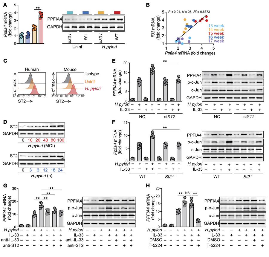 
H. pylori and IL-33 induce PPFIA4 synergistically.
(A) Ppfia4 expressio...