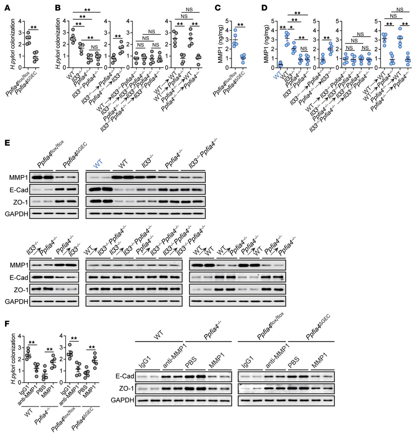 PPFIA4 promotes MMP1 expression leading to increased bacterial burden du...