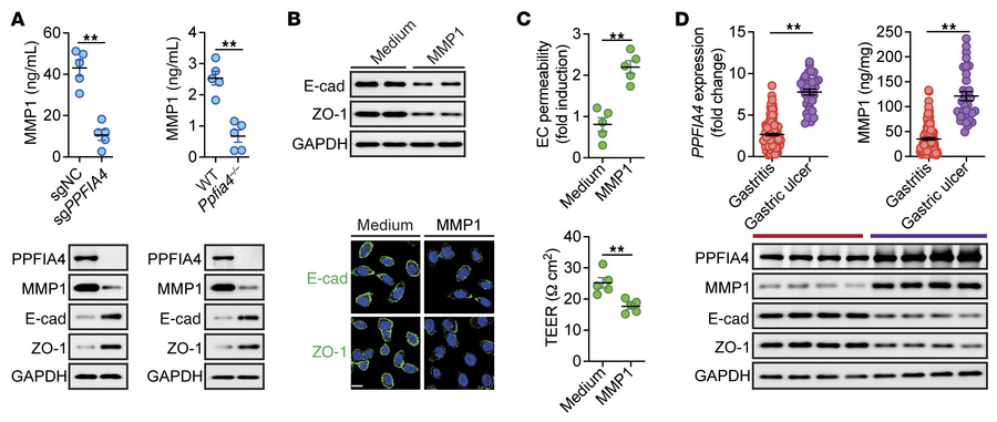 PPFIA4 promotes MMP1 expression, leading to gastric mucosal damage durin...