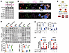 PPFIA4/CASK promotes NF-κB phosphorylation via interaction with and activat