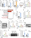 RT-MPs upregulate Ccl20 expression in macrophages through cGAS-STING/NF-κB