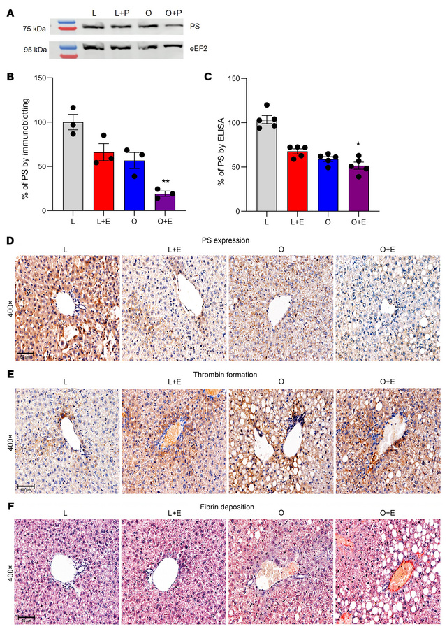The combined effects of obesity and estrogen on the downregulation of PS...