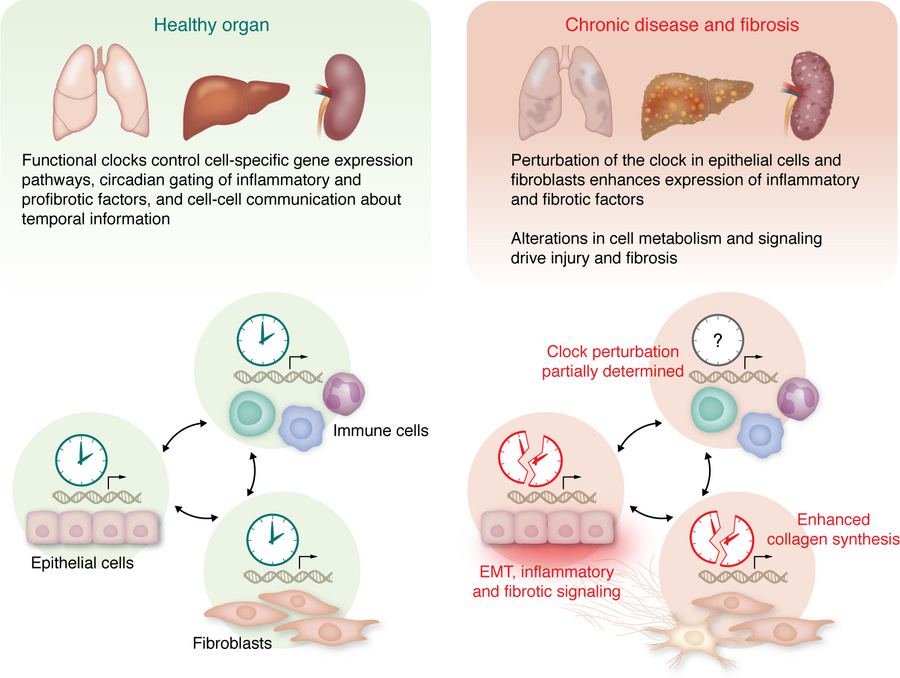JCI - Perturbation of the circadian clock in chronic diseases involving ...