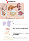 Common steps in organ fibrosis.