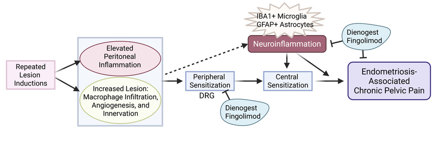 子宮内膜症の慢性痛の原因を解明（Why endometriosis causes chronic pain）