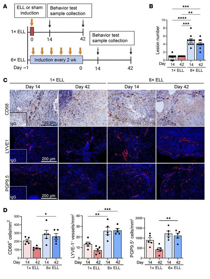 Multiple lesion induction mouse model of endometriosis.
(A) Experimental...