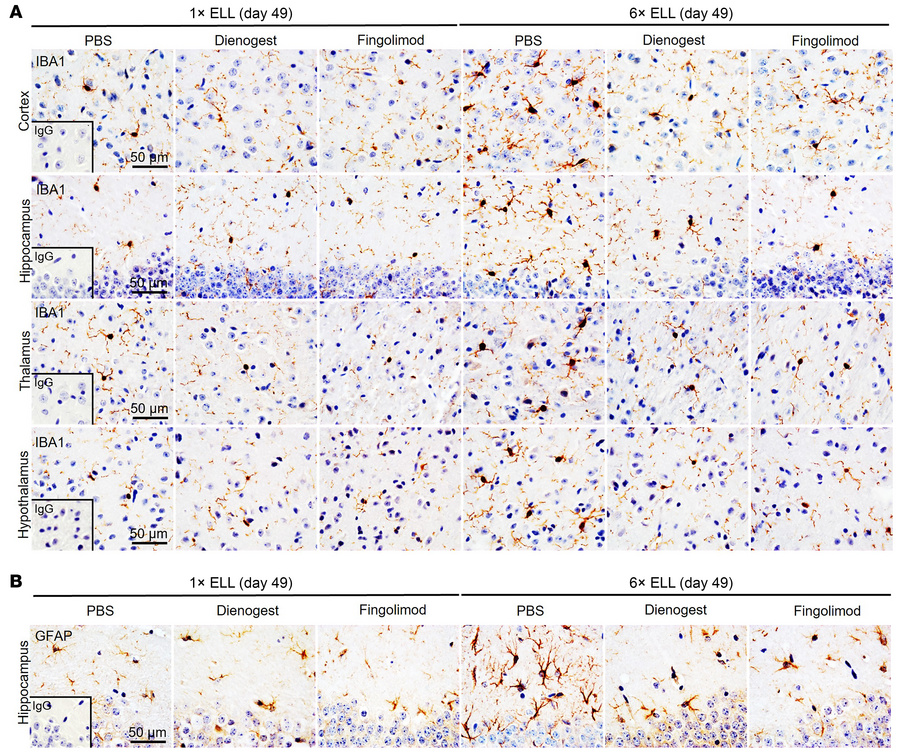IBA1 and GFAP in the mouse brain.
Representative immunohistochemical ima...