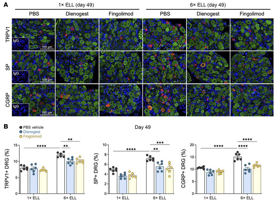 Expression of TRPV1, SP, and CGRP in DRG in the single- or multiple-indu...