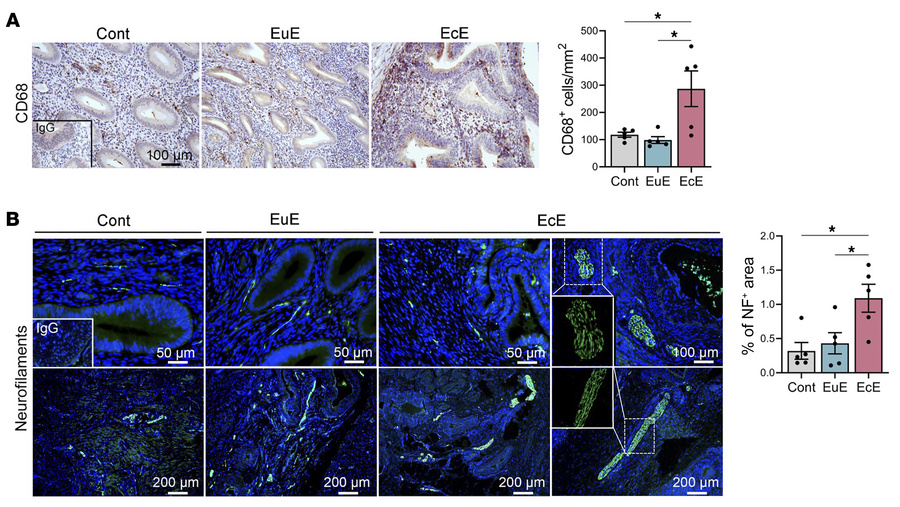 Spontaneously developed endometriosis in rhesus macaques.
(A) Representa...