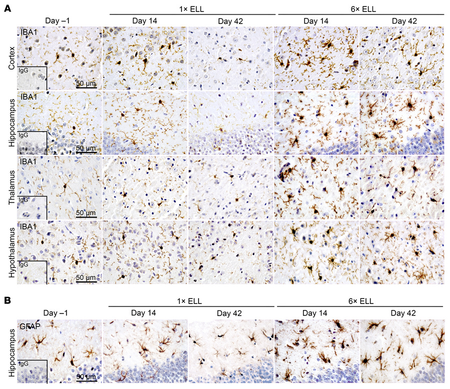 IBA1 and GFAP in the mouse brain.
Representative immunohistochemical ima...