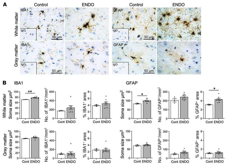 IBA1 and GFAP in the rhesus macaque brain.
Representative immunohistoche...