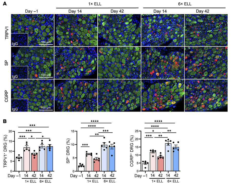 Expression of TRPV1, SP, and CGRP in DRG in single- or multiple-inductio...