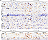 IBA1 and GFAP in the mouse brain.