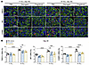 Expression of TRPV1, SP, and CGRP in DRG in the single- or multiple-inducti