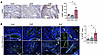 Spontaneously developed endometriosis in rhesus macaques.
