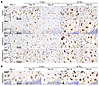 IBA1 and GFAP in the mouse brain.