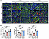 Expression of TRPV1, SP, and CGRP in DRG in single- or multiple-induction m