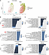 Bilirubin-related (heme) pathways are enriched in B cell subsets in CAV.